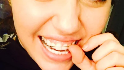 Новий дурнуватий тренд: селфі з пальцем в роті