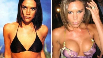 Неочікувана пластика: зірки, які зменшили груди