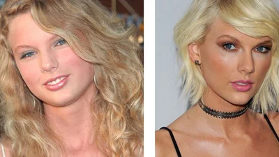 Зірки, які обрізали собі щоки заради краси