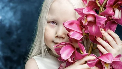 Біліше білого: дівчинка з рідкісною зовнішністю здивувала світ