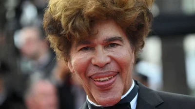 Монстри в Каннах: ведучий шокував обличчям з невдалою пластикою