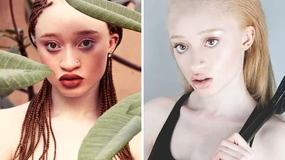 Ці моделі з незвичайною зовнішністю зламали усі стереотипи про красу