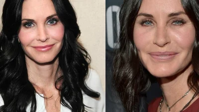 Зірка серіалу "Друзі" розповіла всю правду про невдалу пластику