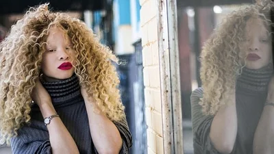 Космічна істота: дівчина стала відомою завдяки унікальній зовнішності