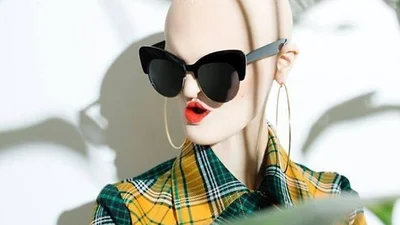 Не така, як усі: дівчина з вражаючою зовнішністю стала моделлю