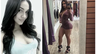 Наприсідала: вас шокують дивні ноги цієї моделі