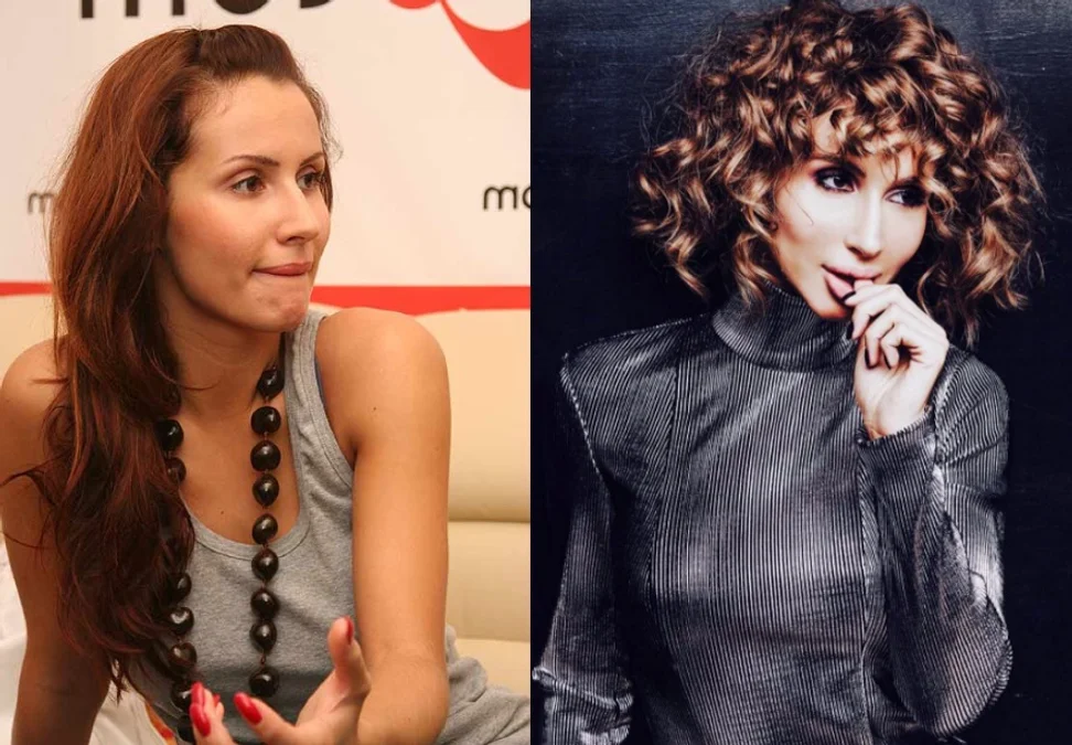 Шокирующие фото Светланы Лободы до и после пластики опубликовали украинцы