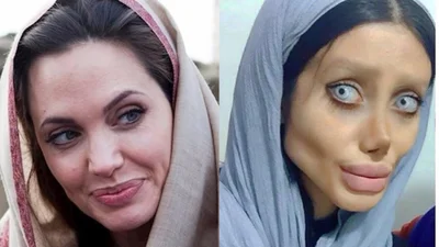Страшная кукла: женщина сделала 50 пластических операций, чтобы стать Анджелиной Джоли