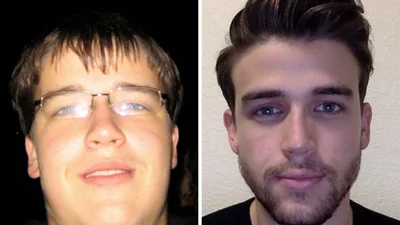 Фантастические фото показывают, как меняются лица людей, когда они худеют