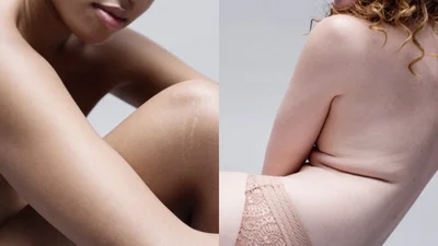 Обнаженные девушки снялись для спецпроекта и показали свои соблазнительные растяжки