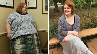 Фото людей,похудевших на 200 килограммов, шокируют и доказывают, что нет невозможного
