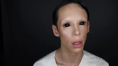 Парень тратит тысячи, чтобы избавиться от пола и стать пришельцем, и вот, как он выглядит