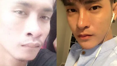 Глупая пластика: таец сделал множество операций, чтобы стать корейцем