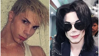 Хлопець зробив 11 операцій, щоб стати Майклом Джексоном - тепер його не впізнає мама