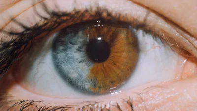 Благодаря выходкам природы, эти люди выглядят странно и красиво одновременно