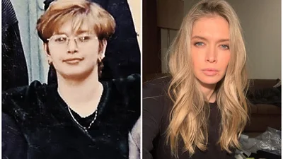 Пластика чи робота над собою: Віра Брежнєва зізналась, як змінила свою зовнішність