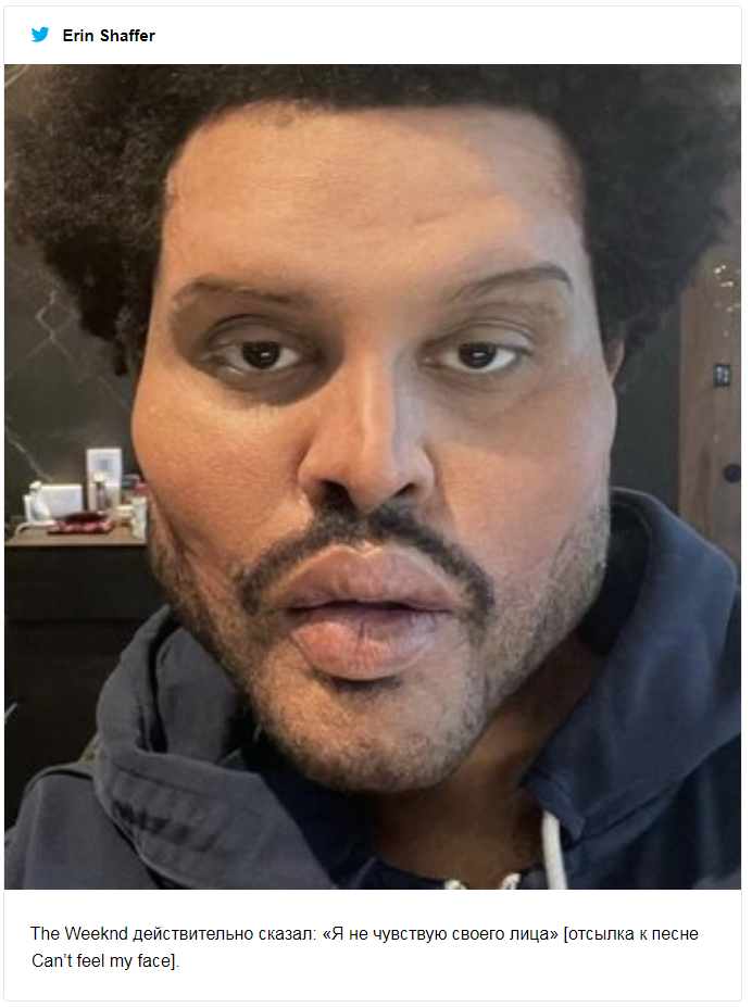 The Weeknd показал себя после пластики, и волну новых мемов о его образе уже не остановить - 502695 The Weeknd показал себя после пластики, и волну новых мемов о его образе уже не остановить - фото 502695