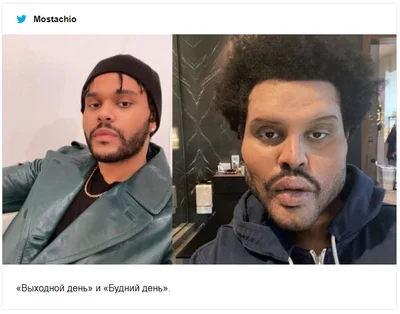 The Weeknd показав себе після пластики, і хвилю нових мемів про його образ вже не спинити - фото 502696