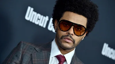 The Weeknd показал себя после пластики, и волну новых мемов о его образе уже не остановить