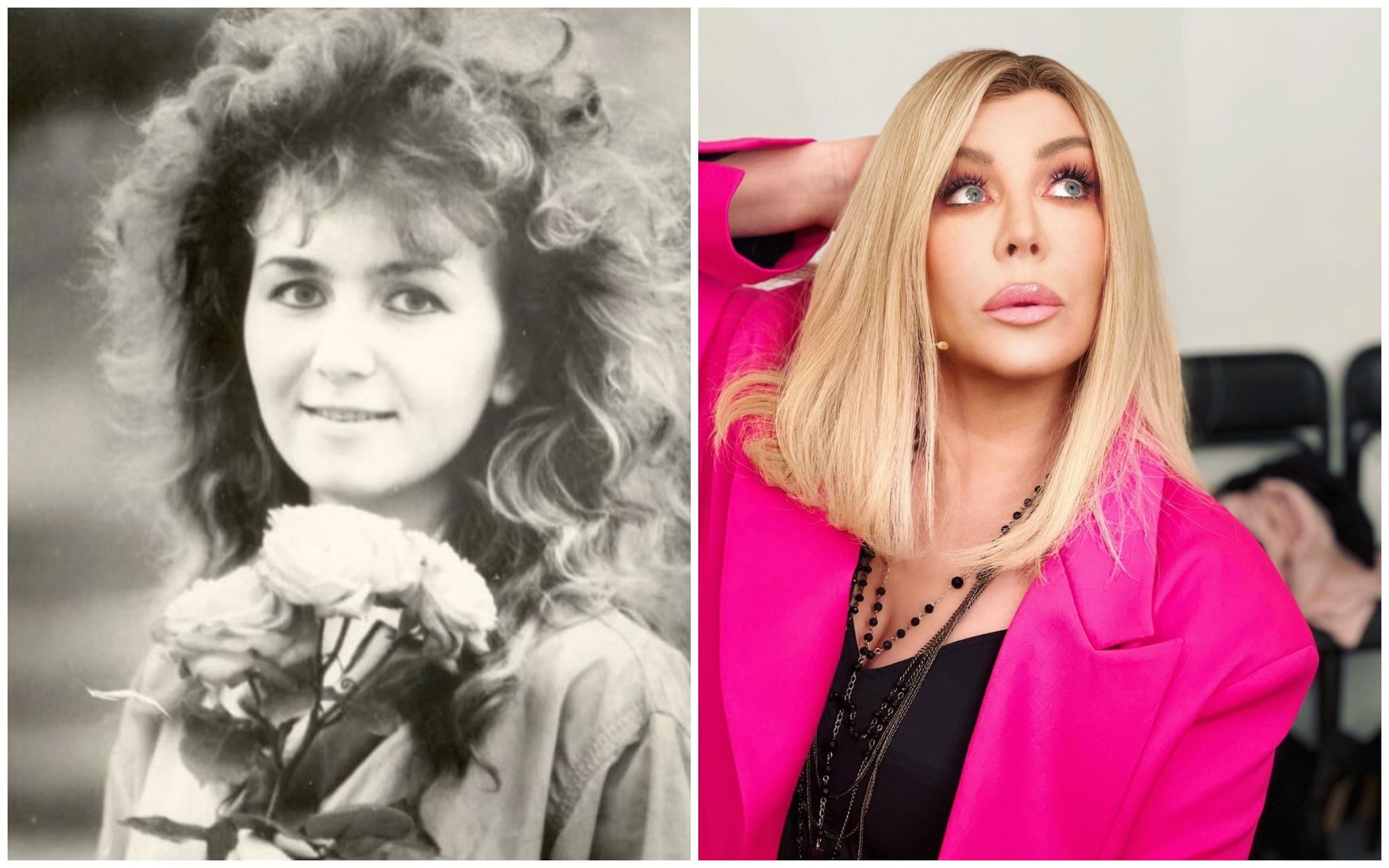 Ірина Білик до та після пластики - 536787 Ірина Білик до та після пластики - фото 536787