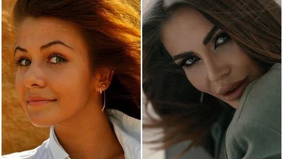 5 українських блогерок, які зробили пластику, і це їх кардинально змінило