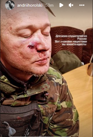Хлывнюк попал под обстрел и показал фанатам из России, с какими нацистами они воюют - 541850 Хлывнюк попал под обстрел и показал фанатам из России, с какими нацистами они воюют - фото 541850