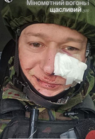 Хлывнюк попал под обстрел и показал фанатам из России, с какими нацистами они воюют - 541851 Хлывнюк попал под обстрел и показал фанатам из России, с какими нацистами они воюют - фото 541851