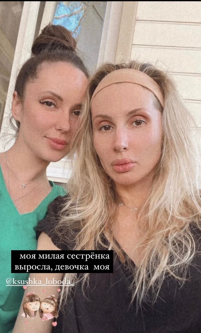 Светлана Лобода показала неотфотошопленное фото без макияжа и с младшей сестрой - фото 545826