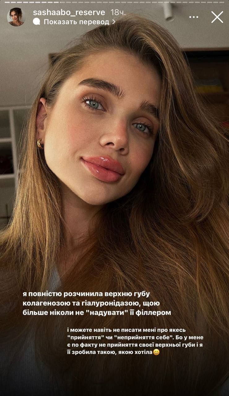 Саша Бо показала, как 'переделала' с помощью пластической операции свои губы - 550192 Саша Бо показала, как 'переделала' с помощью пластической операции свои губы - фото 550192
