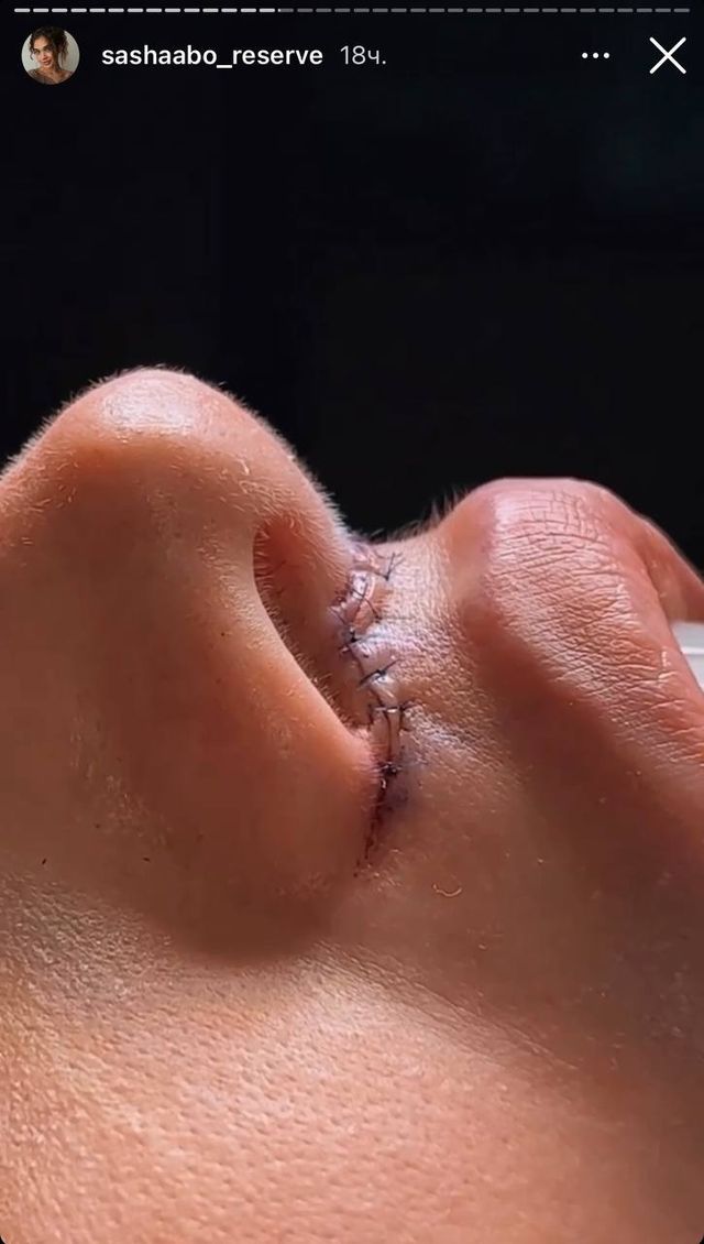 Саша Бо показала, как 'переделала' с помощью пластической операции свои губы - фото 550193
