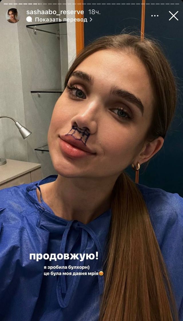 Саша Бо показала, как 'переделала' с помощью пластической операции свои губы - фото 550194