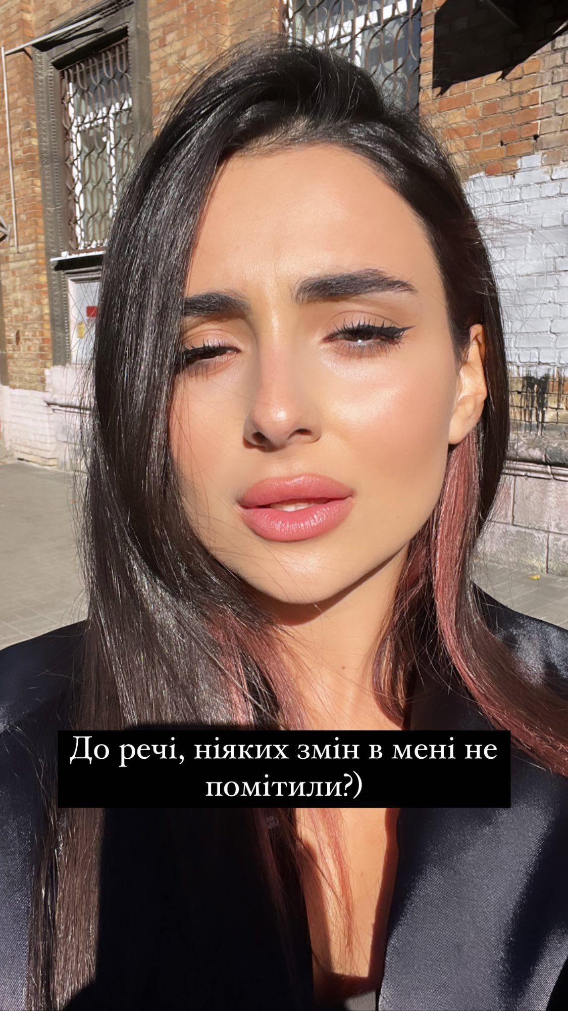 Анна Тринчер изменила форму лица - фото 550309