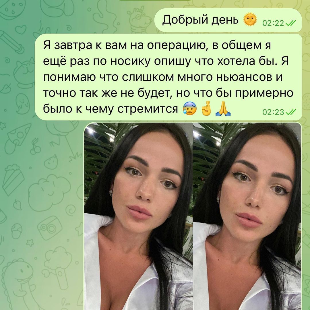 Марина з 'Холостяка-12' показала себе до пластики та уколів краси - фото 552070