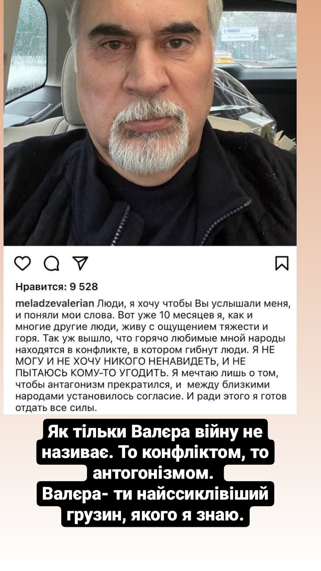 Анатолій Анатоліч засудив Валерія Меладзе, який назвав війну 'конфліктом' - фото 552390