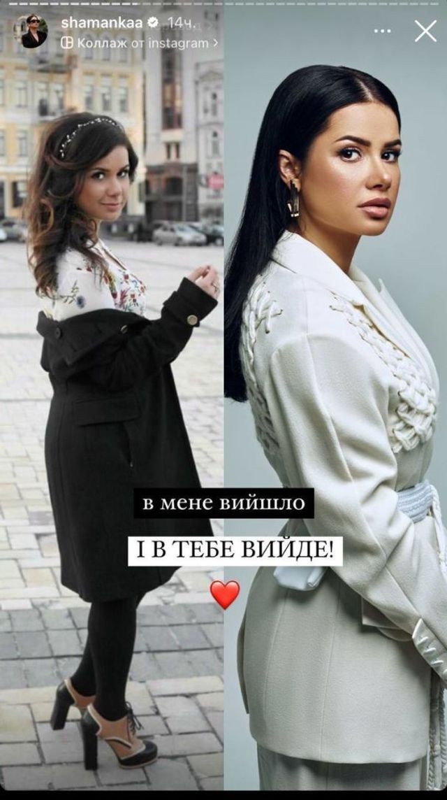Превращение блогерки: Алина Шаманская показала, как пластика изменила ее внешность - фото 553956