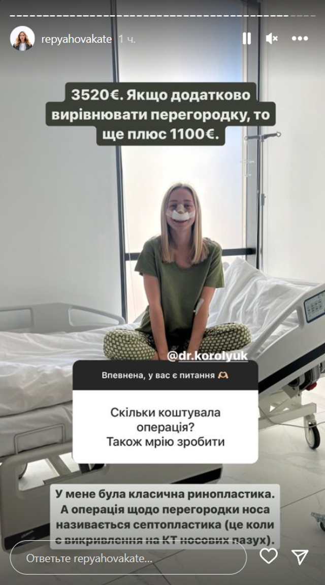 Катерина Репяхова відповіла, скільки заплатила за пластику носа - фото 555134