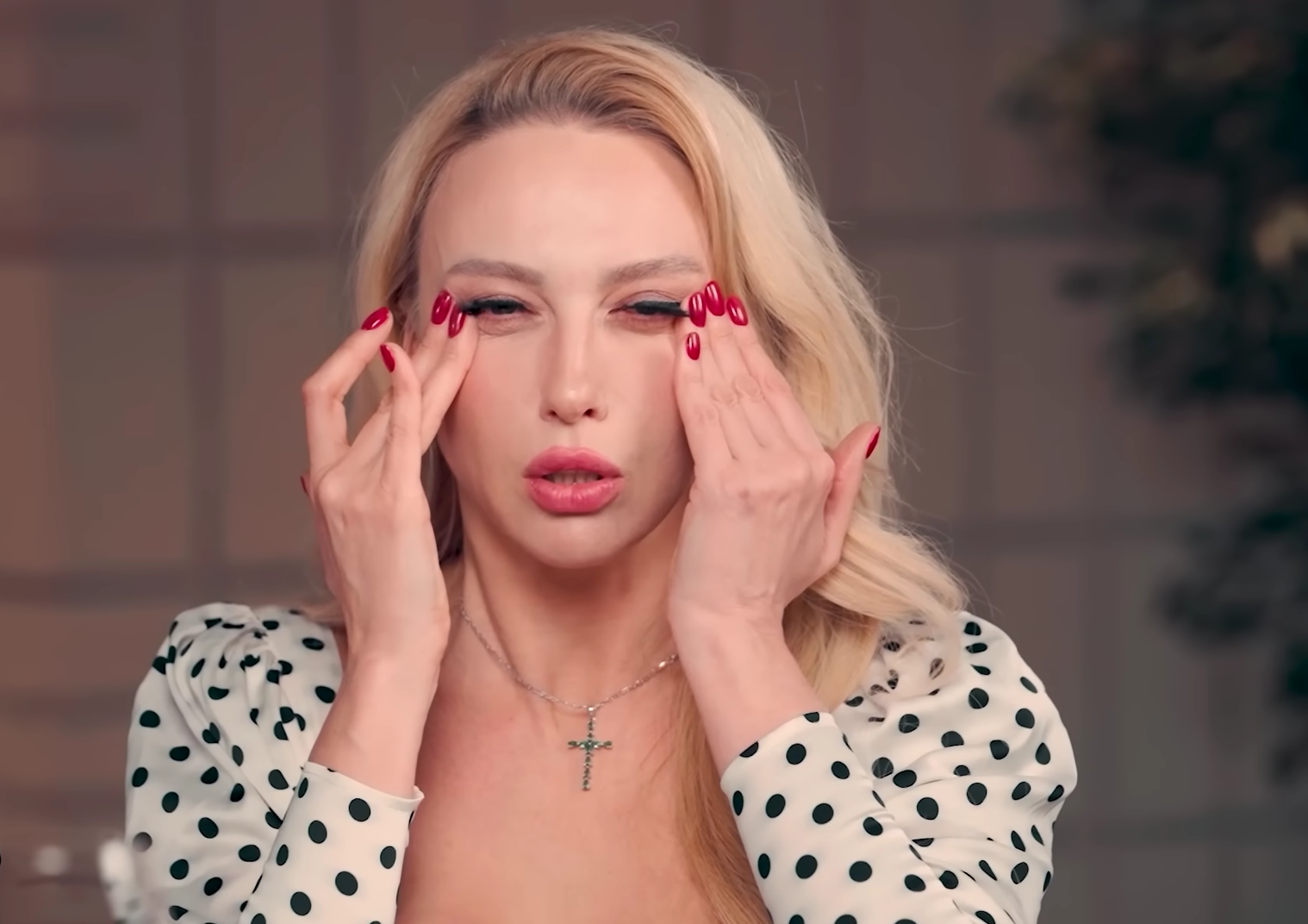Оля Полякова рассказала, что делает для подтяжки лица - фото 556782
