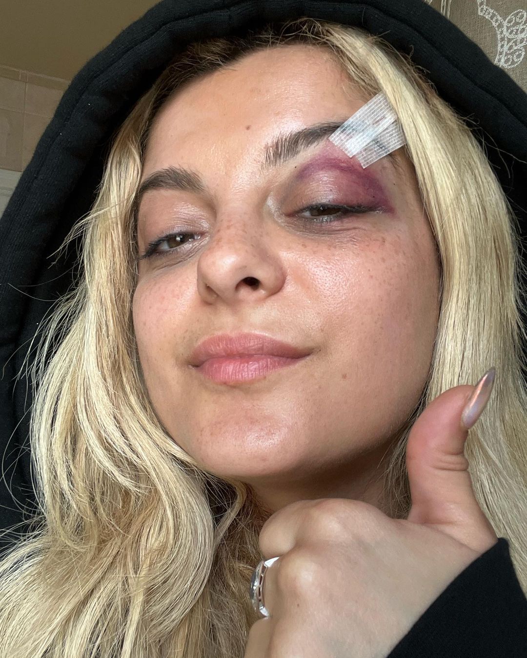 Співачці Bebe Rexha фанат розбив обличчя під час концерту - 560886 Співачці Bebe Rexha фанат розбив обличчя під час концерту - фото 560886