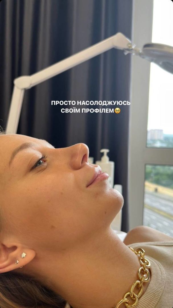 Катерина Репяхова показала, як збільшила губи: фото 'до' і 'після' ін'єкції - 561708 Катерина Репяхова показала, як збільшила губи: фото 'до' і 'після' ін'єкції - фото 561708