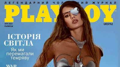 Українка, що постраждала від обстрілу окупантів, прикрасила обкладинку Playboy