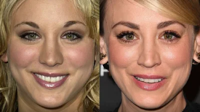 До та після: зірки, які робили пластику носа