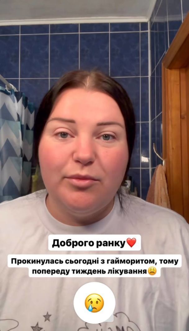 'Впереди - лечение': Alyona Alyona сообщила о проблемах со здоровьем - фото 568983