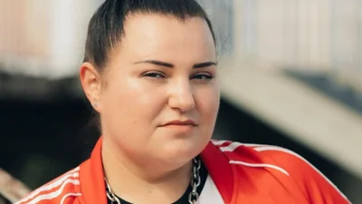 "Впереди - лечение": Alyona Alyona сообщила о проблемах со здоровьем