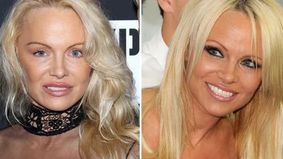 Памела Андерсон навсегда отказалась от макияжа — причина тебя удивит