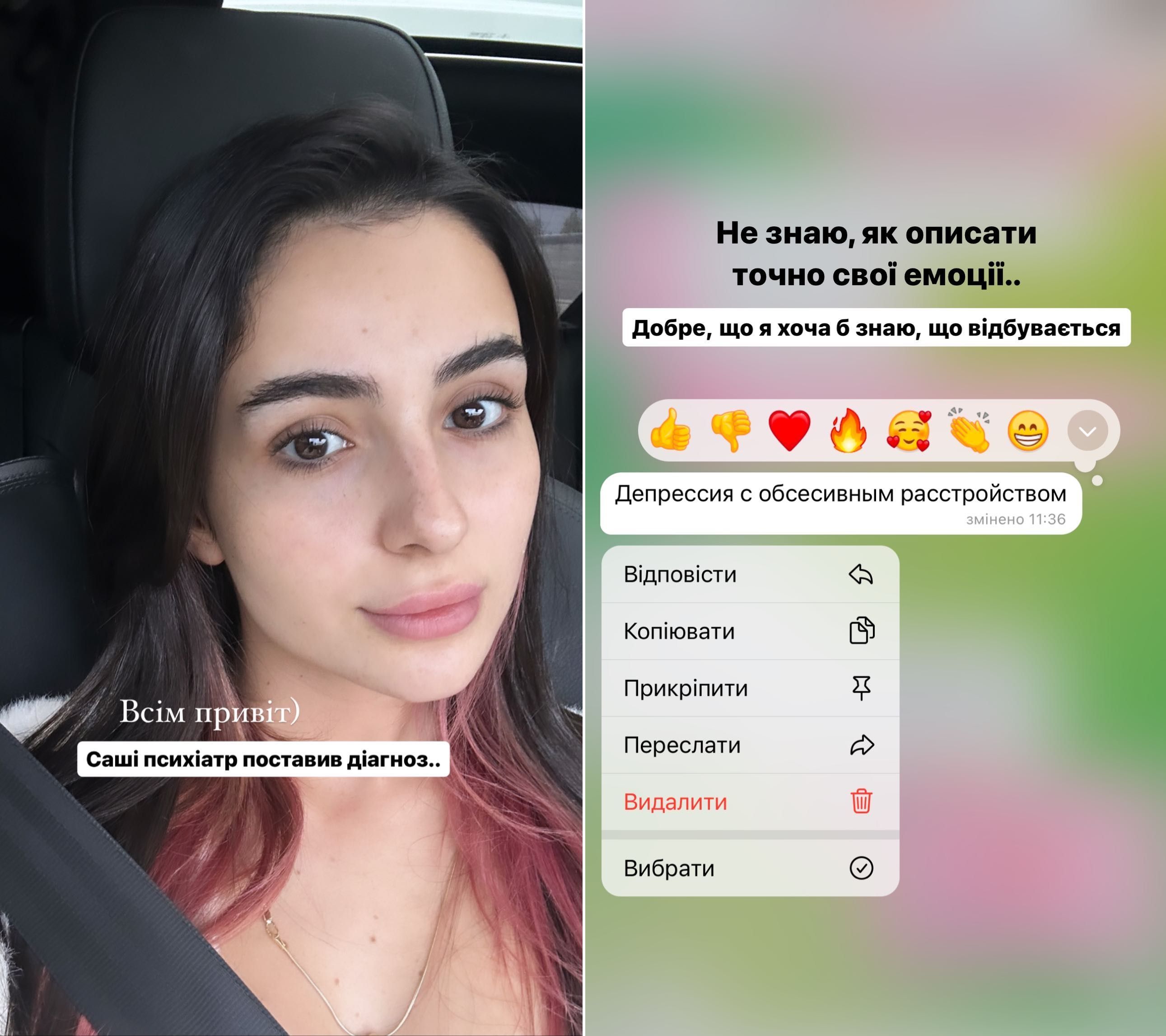 Анна Трінчер розповіла про діагноз чоловіка, який впливає на їхній шлюб - 572632 Анна Трінчер розповіла про діагноз чоловіка, який впливає на їхній шлюб - фото 572632