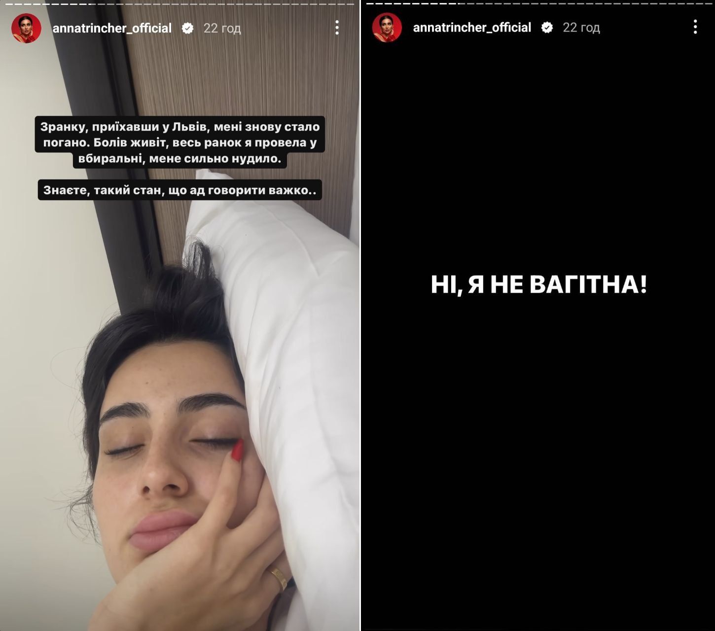 Анна Трінчер відповіла на чутки про вагітність - фото 577287