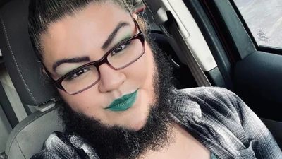 Жінка з бородою відверто розповіла про своє життя та показала хлопця