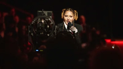 Хірург розповів та показав, які пластичні операції робила Мадонна — фото