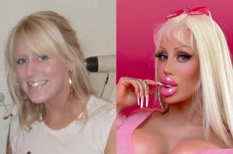 Живая Барби: женщина превратила себя в куклу за 120 тысяч долларов — вот до и после
