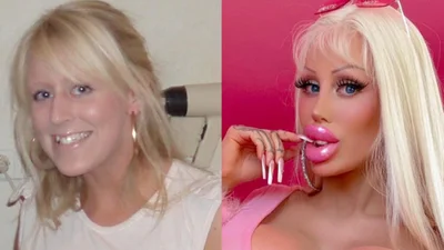 Живая Барби: женщина превратила себя в куклу за 120 тысяч долларов — вот до и после